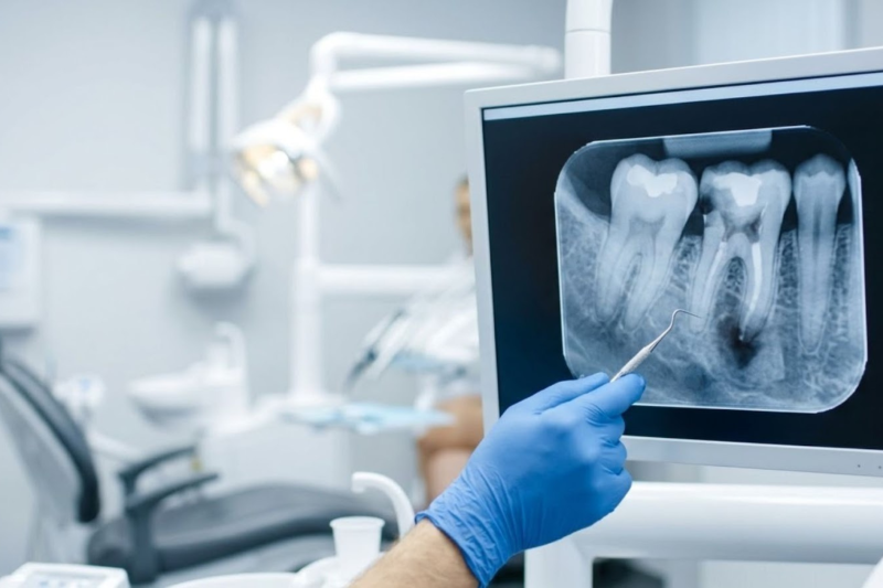 x-ray image indicating possible need for root canal treatment.